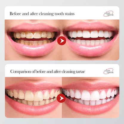 2X1 Crema Dental Nicotinamida🦷- ¡TRANSFORMA TU VIDA EN SOLO 1 SEMANA!