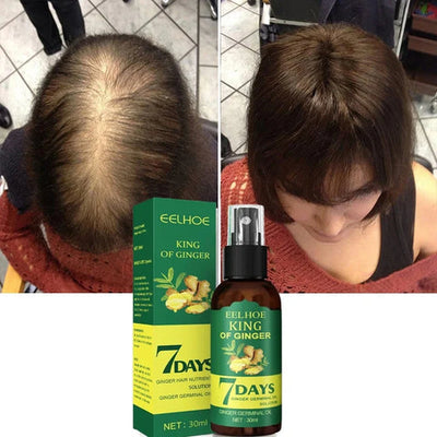 Elixir Capilar Crecimiento En 7 Días 👨‍🦱 - PAGUE 1 Y LLEVA 2!!!🤩